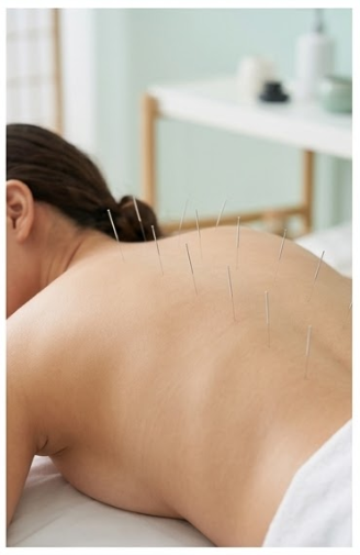 Acupuncture treatment